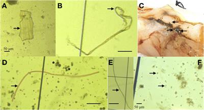 Evidence of Marine Microplastics in Commercially Harvested Seafood